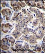 RPL15 Antibody in Immunohistochemistry (Paraffin) (IHC (P))