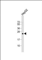 RPL15 Antibody in Western Blot (WB)
