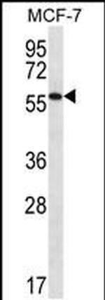 SAAL1 Antibody in Western Blot (WB)