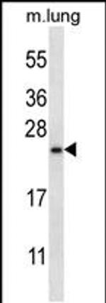 RHEBL1 Antibody in Western Blot (WB)