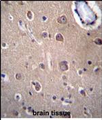 SLC8A3 Antibody in Immunohistochemistry (Paraffin) (IHC (P))