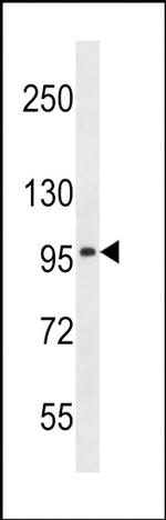 SLC8A3 Antibody in Western Blot (WB)