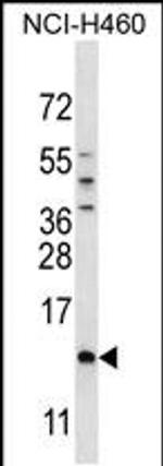 SMCP Antibody in Western Blot (WB)