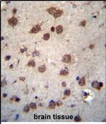 PHAX Antibody in Immunohistochemistry (Paraffin) (IHC (P))