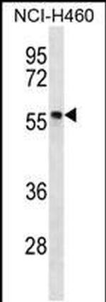 PHAX Antibody in Western Blot (WB)