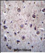 DOC2A Antibody in Immunohistochemistry (Paraffin) (IHC (P))