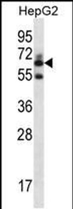 GGT2 Antibody in Western Blot (WB)