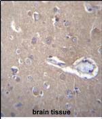 SEC62 Antibody in Immunohistochemistry (Paraffin) (IHC (P))