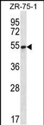 SEC62 Antibody in Western Blot (WB)