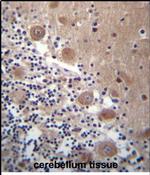 SCHIP1 Antibody in Immunohistochemistry (Paraffin) (IHC (P))