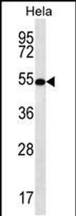 SCHIP1 Antibody in Western Blot (WB)