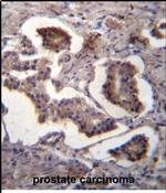 GUF1 Antibody in Immunohistochemistry (Paraffin) (IHC (P))
