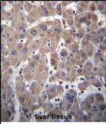 YIPF1 Antibody in Immunohistochemistry (Paraffin) (IHC (P))
