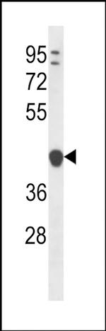 YIPF1 Antibody in Western Blot (WB)