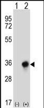 CBR3 Antibody in Western Blot (WB)