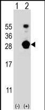 FKBP7 Antibody in Western Blot (WB)