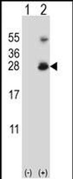 RNF11 Antibody in Western Blot (WB)