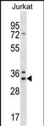 DNAJC9 Antibody in Western Blot (WB)