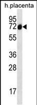 SCLT1 Antibody in Western Blot (WB)