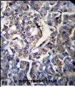 RPL35 Antibody in Immunohistochemistry (Paraffin) (IHC (P))