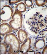 MBTPS2 Antibody in Immunohistochemistry (Paraffin) (IHC (P))