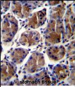 GIF Antibody in Immunohistochemistry (Paraffin) (IHC (P))