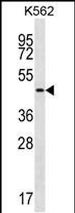 GIF Antibody in Western Blot (WB)