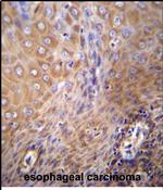 SLC6A14 Antibody in Immunohistochemistry (Paraffin) (IHC (P))