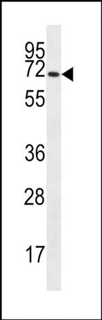 SLC6A14 Antibody in Western Blot (WB)