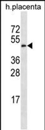 GAL3ST4 Antibody in Western Blot (WB)