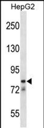 CATSPER1 Antibody in Western Blot (WB)