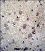 HBQ1 Antibody in Immunohistochemistry (Paraffin) (IHC (P))
