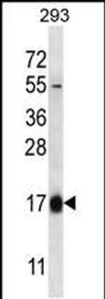 HBQ1 Antibody in Western Blot (WB)