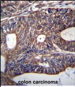 UQCRB Antibody in Immunohistochemistry (Paraffin) (IHC (P))