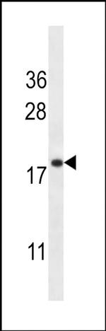 TMEM70 Antibody in Western Blot (WB)