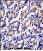 ODF2L Antibody in Immunohistochemistry (Paraffin) (IHC (P))