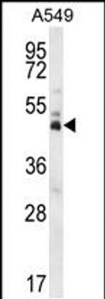 DUX4 Antibody in Western Blot (WB)
