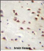 ANKRD6 Antibody in Immunohistochemistry (Paraffin) (IHC (P))