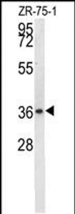 NIT1 Antibody in Western Blot (WB)