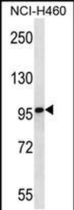 EndoGlyx-1 Antibody in Western Blot (WB)