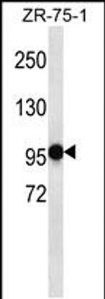 PHF14 Antibody in Western Blot (WB)