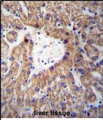 GLYAT Antibody in Immunohistochemistry (Paraffin) (IHC (P))
