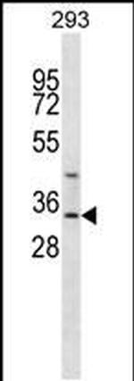 GLYAT Antibody in Western Blot (WB)