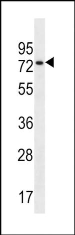 NSRP1 Antibody in Western Blot (WB)