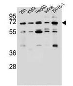 KCNV2 Antibody in Western Blot (WB)