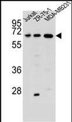 ZSCAN2 Antibody in Western Blot (WB)