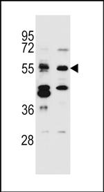TNRC4 Antibody in Western Blot (WB)