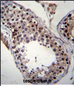 SPATA19 Antibody in Immunohistochemistry (Paraffin) (IHC (P))