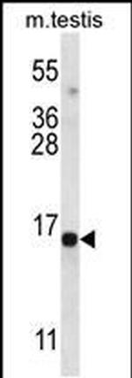 SPATA19 Antibody in Western Blot (WB)