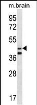 ORC5L Antibody in Western Blot (WB)